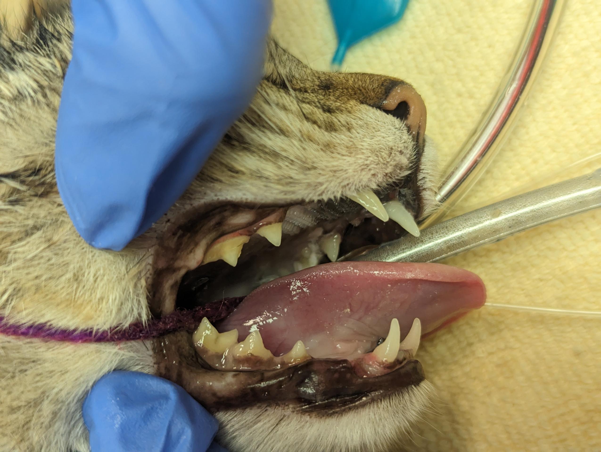 Clean Teeth 2 Clean Teeth 2