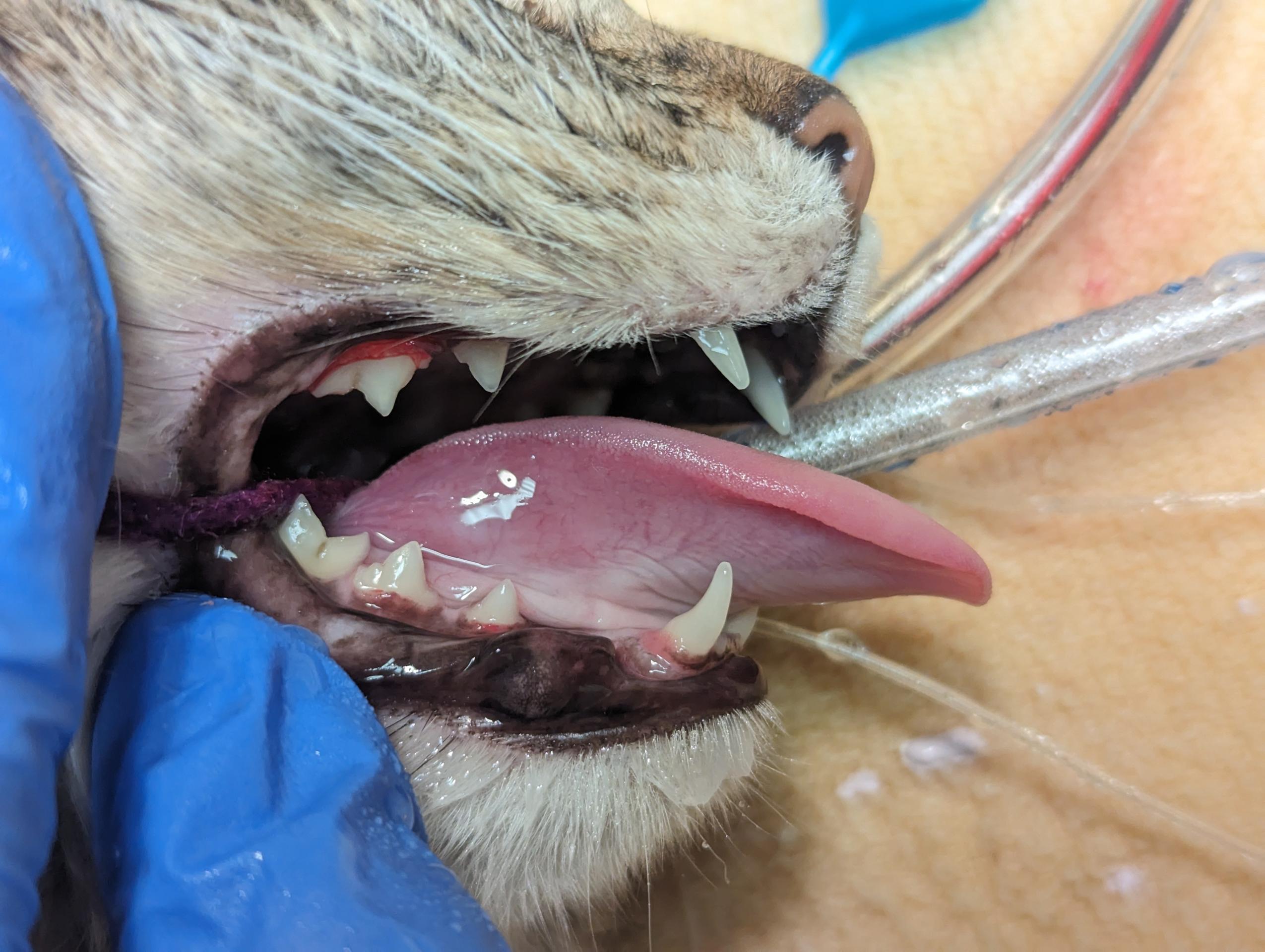 Clean Teeth 1 Clean Teeth 1